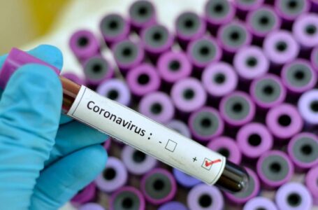 Arapongas registra mais 38 casos de Covid-19 e 13 são profissionais de saúde